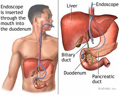 endoscopic.jpg