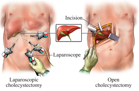 laparoscopic.jpg